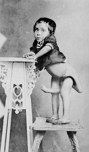 Antique medical oddity - medical, photo