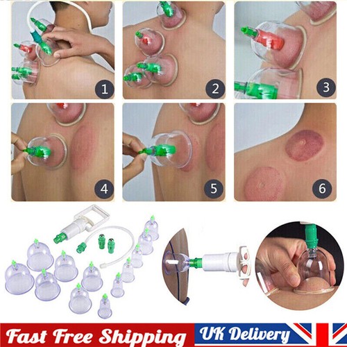 Cups set medical - 12,