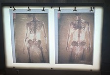 Halloween , Vintage X-Ray Light Box Viewer – 75 x 58cm– Medical Metal Unit