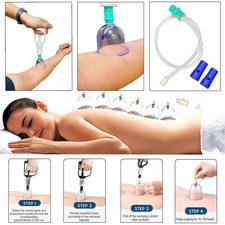 12PCS Cupping Vacuum Massage Cups Therapy Set Health Acupuncture Suction UK