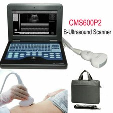 CMS600P2 Portable Ultrasound Scanner Laptop Ultrasound Machine 3.5M Convex Probe