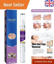 Wart Freeze Remover Pen - Fast and Gentle Treatment for All Skin Types