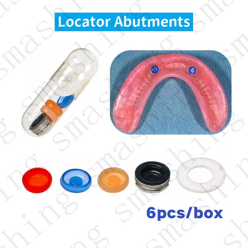Overdenture dental locator - dental,