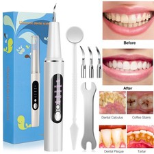 Ultrasonic Tooth Cleaner Electric Dental Scaler Tartar Plaque Calculus Remover