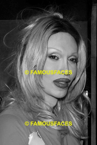 Pete burns dead alive - dead,