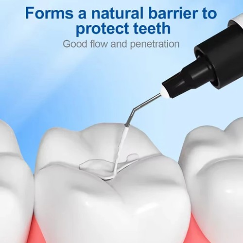 Dental pit fissure - dental,