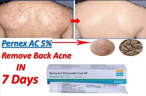New pernex 5 - ac, 5%