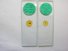 2 Antique Microscope  Slides. Kittiwake and Peacock Louse.