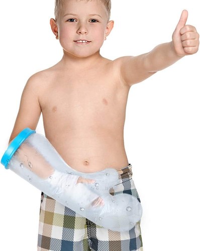 Kids arm cast covers - kids,