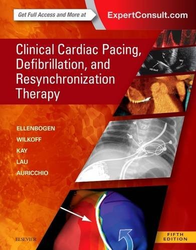 Clinical cardiac pacing - cardiac,