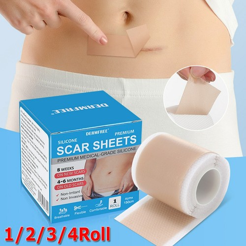 15m medical grade - grade, scar