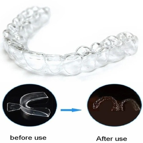 Teeth corrector braces - teeth, adult