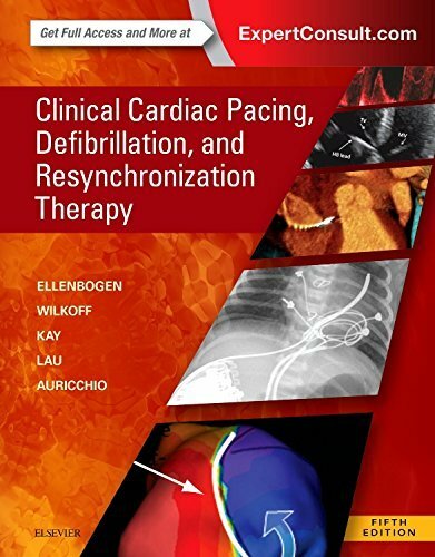 Clinical cardiac pacing - clinical,