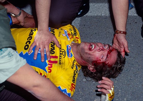 Mario cipollini after crash - mario, a