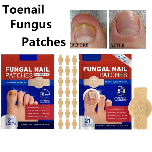 Patches fungal nail - 21,