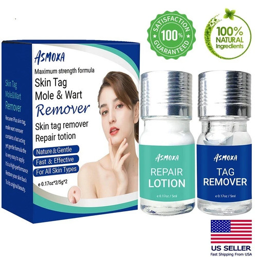 Skin tag remover and - tag,
