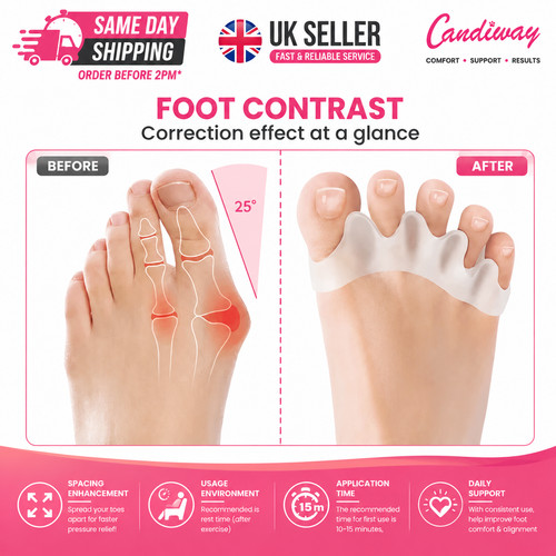 2pcs silicone toe separator - 2pcs,
