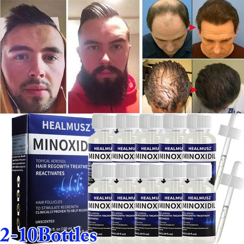 Minoxidil extra strength - minoxidil,