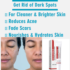 New Niacinamide Cream Whitening Remove Dark Spots Anti-Freckle Cream Fade