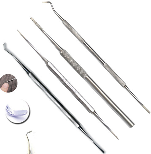 Ingrown toe nail file - ingrown,