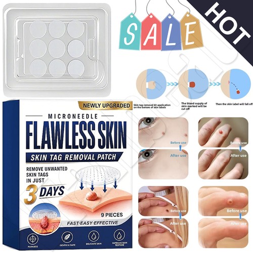 Skin tag remover - patches, quick