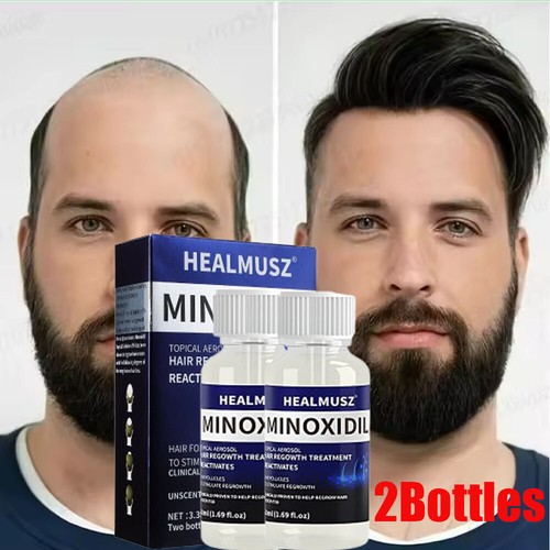 Minoxidil extra strength - 5%,