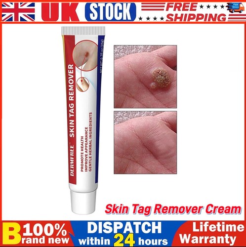 Strong skin tag remover cream - skin,