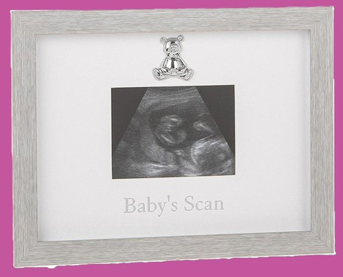 Beautiful baby scan photo - beautiful,