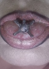 8X Spare Replacement Silicone