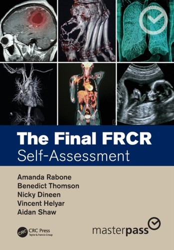 The final frcr - the, by