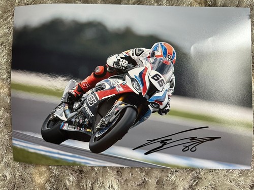 Tom sykes hand - tom,