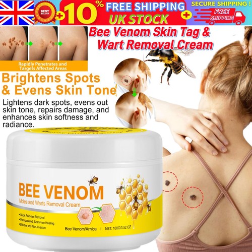 Strong skin tag - remover, cream