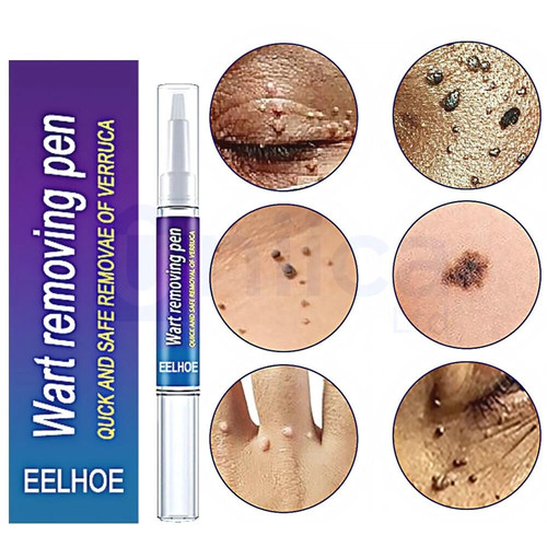 Wart remover pen - pen, tags