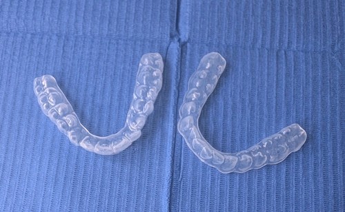 Custom dental orthodontic - custom,