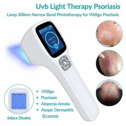 308nm narrowband uvb light - uvb,