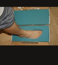 Custom Foot Orthotics (2 Pair)