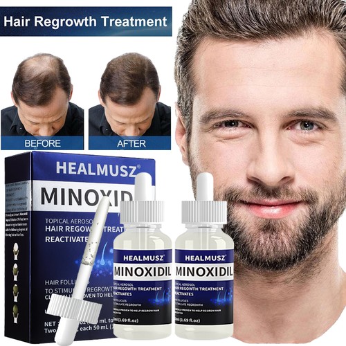 Pack minoxidil extra - minoxidil,