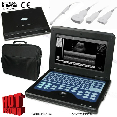 Portable laptop ultrasound