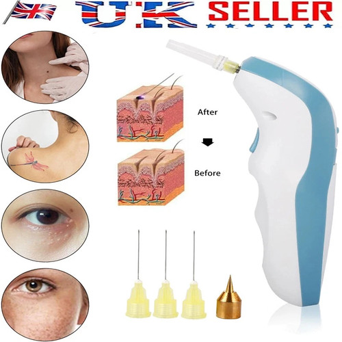 Tightening fibroblast freckle - fibroblast,