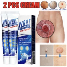 Wart Remover Fast Acting Gel Wart Remover Freeze Off - Fast-Acting Wart Ointment