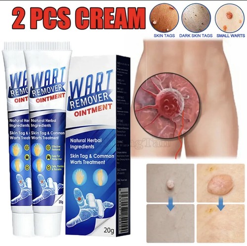 Wart remover fast acting - remover,