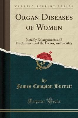 Organ diseases women - organ,
