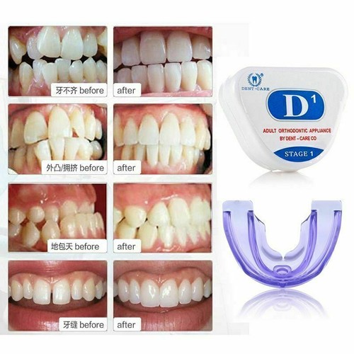 Myobrace dental orthodontic - myobrace,