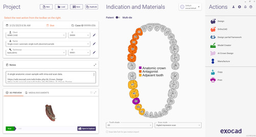 3shape 2025 exocad - 3shape, full