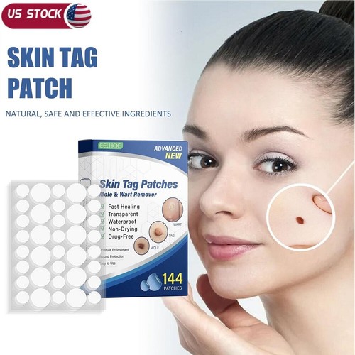 288 skin tag - 288×, remover