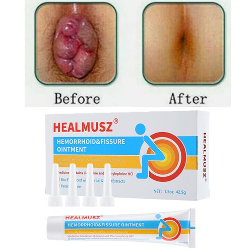 Healmusz hemorrhoid cream - healmusz,