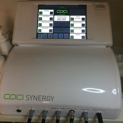 Caci synergy non surgical - synergy,