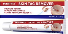 STRONG SKIN TAG REMOVER Cream