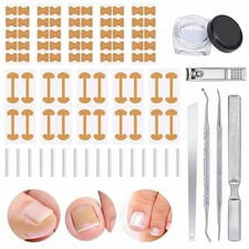 Ingrown Toenail Treatment Tool