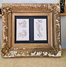 Pair Of Rare Antique Georgian (1825) Anatomical Engravings In  Gilt Gesso Frame